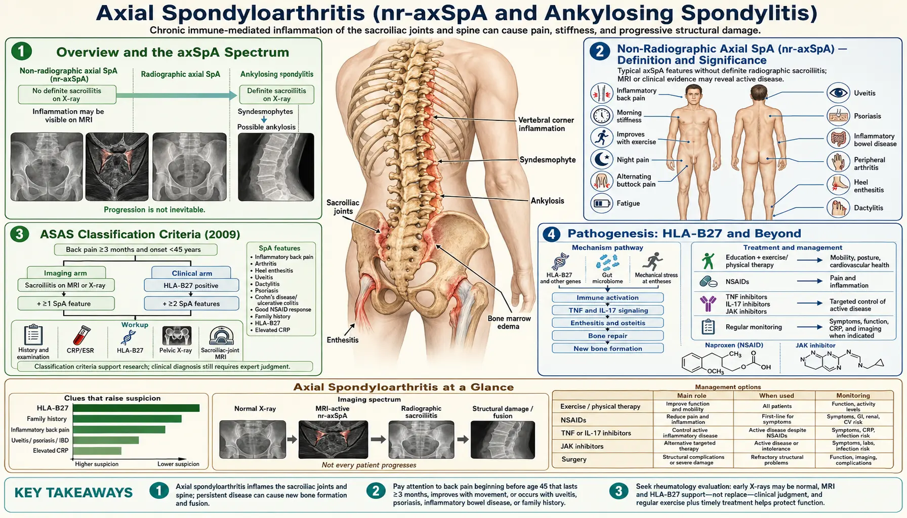 Axial Spondyloarthritis — scientific infographic poster