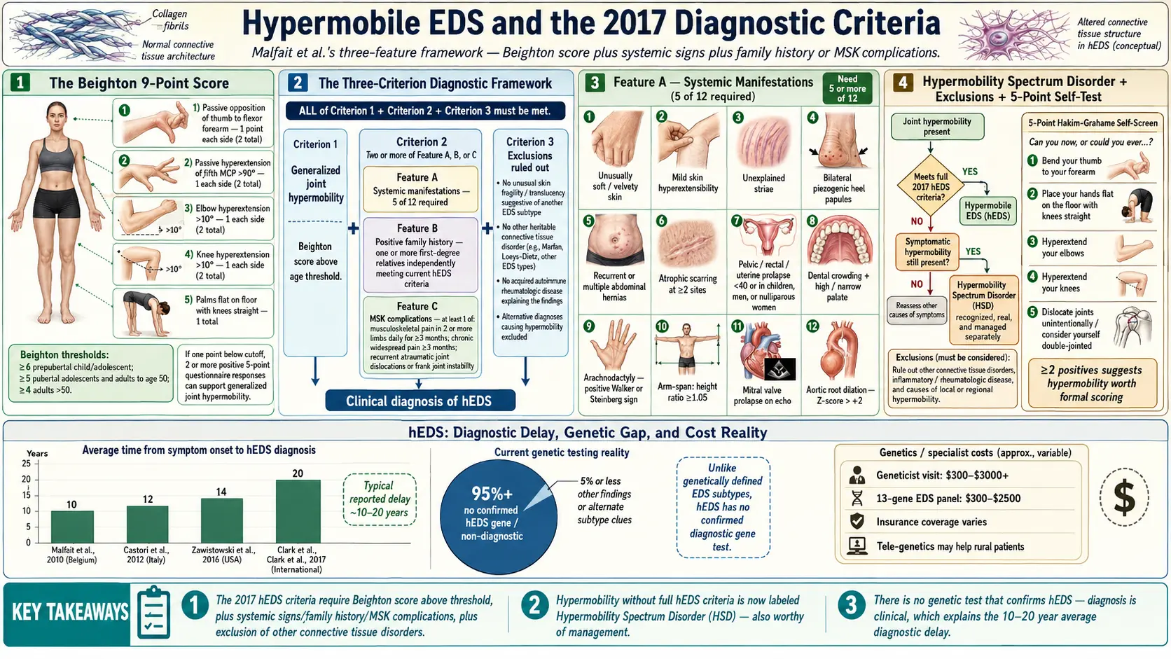 Hypermobile EDS and 2017 Diagnostic Criteria — scientific infographic poster
