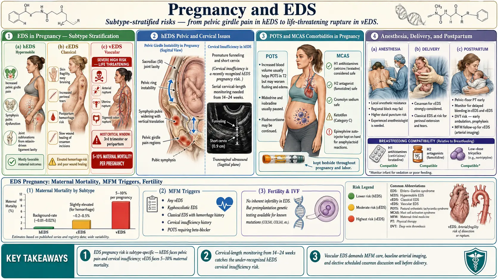 Pregnancy and EDS — scientific infographic poster
