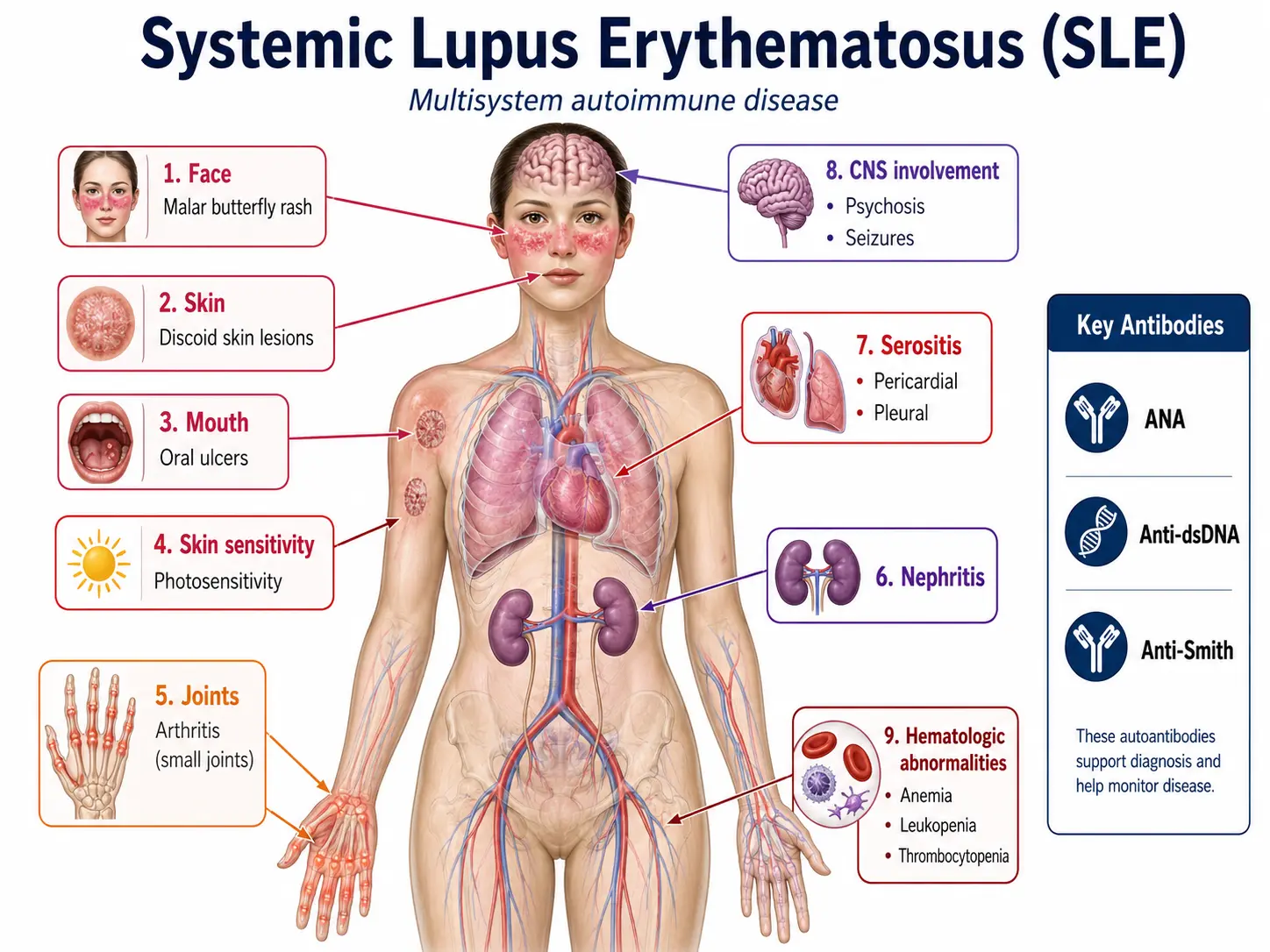 Multi-system manifestations of lupus