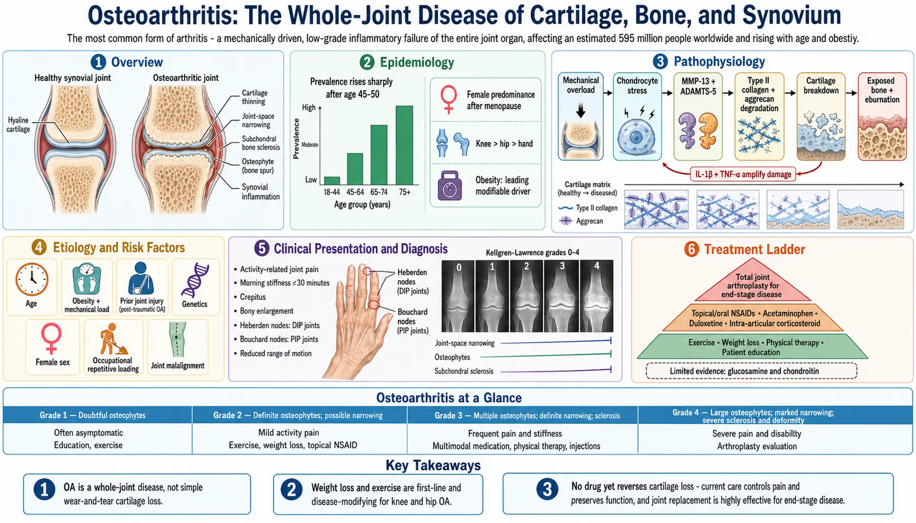 Osteoarthritis — scientific infographic poster