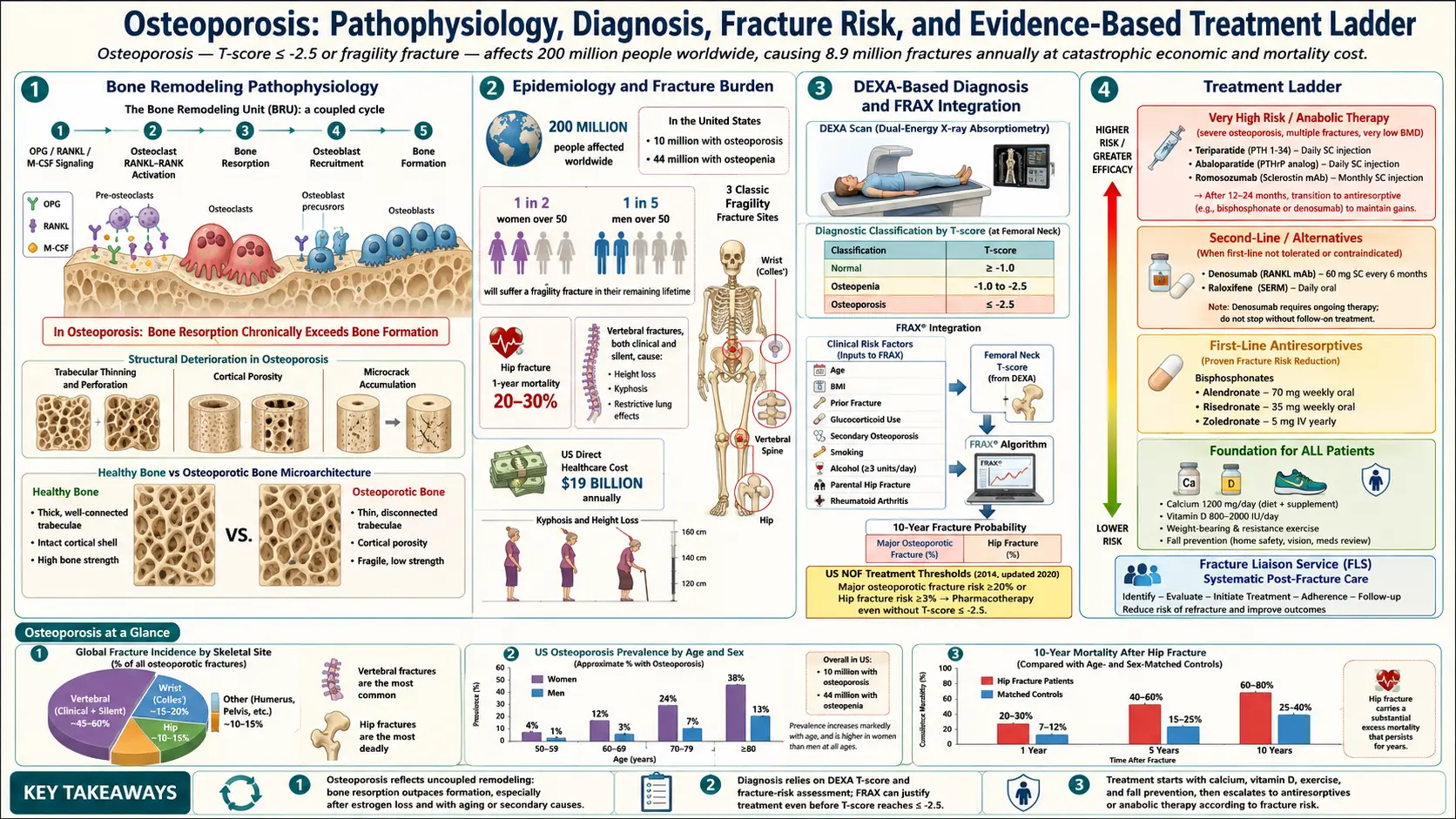 Osteoporosis — scientific infographic poster