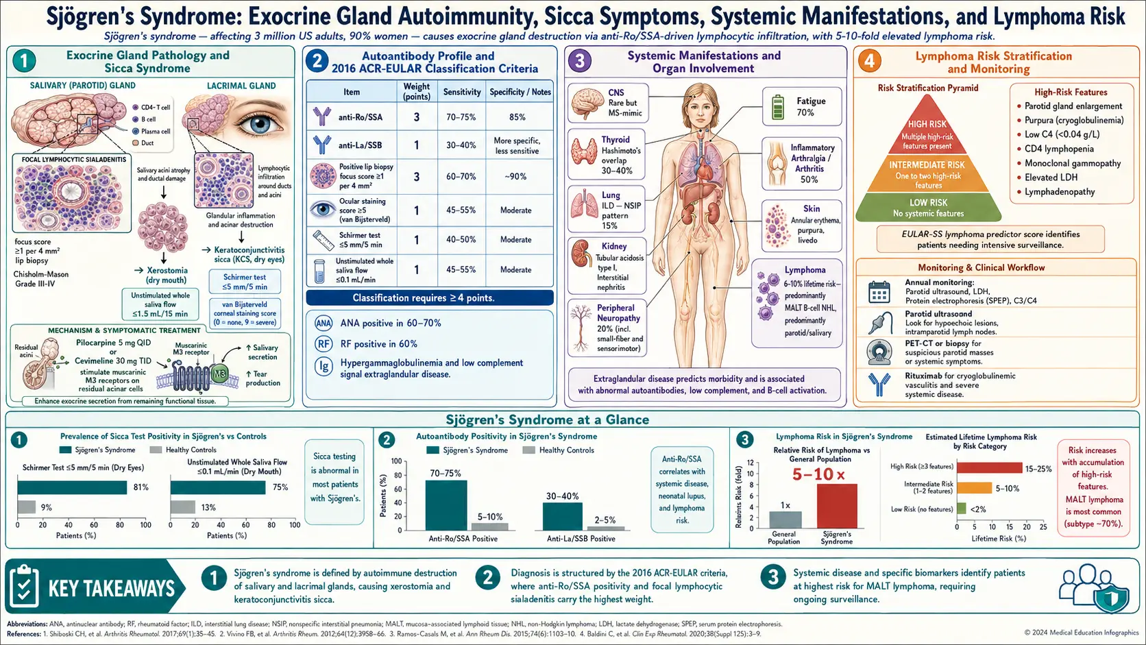 Sjogrens Syndrome — scientific infographic poster