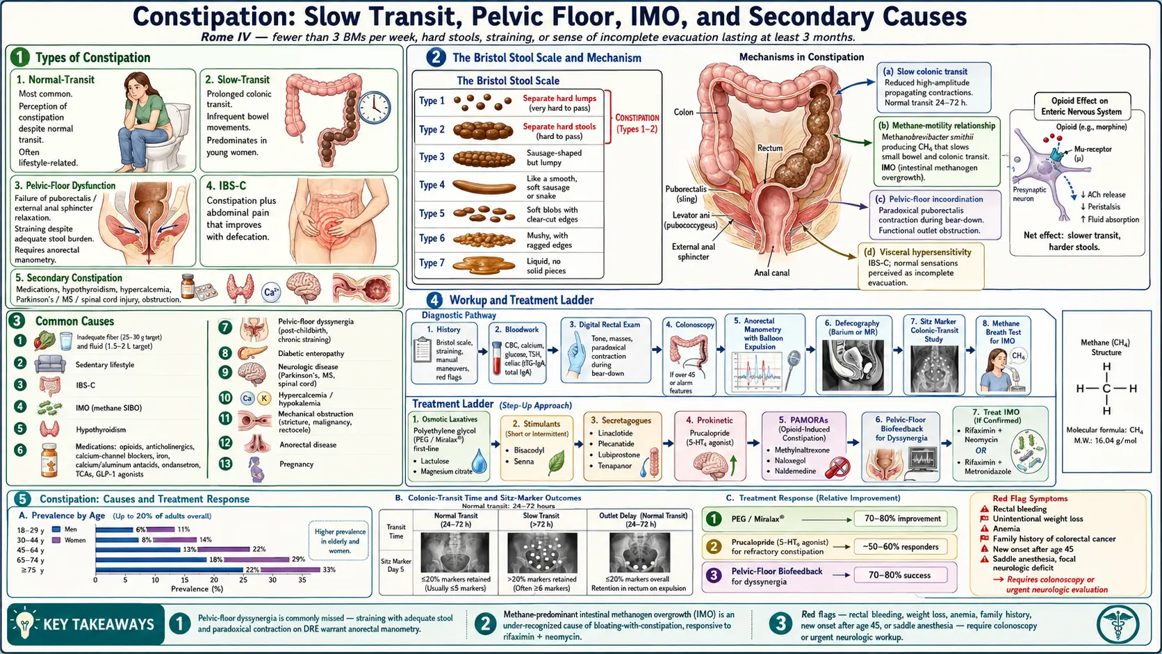 Constipation — scientific infographic poster