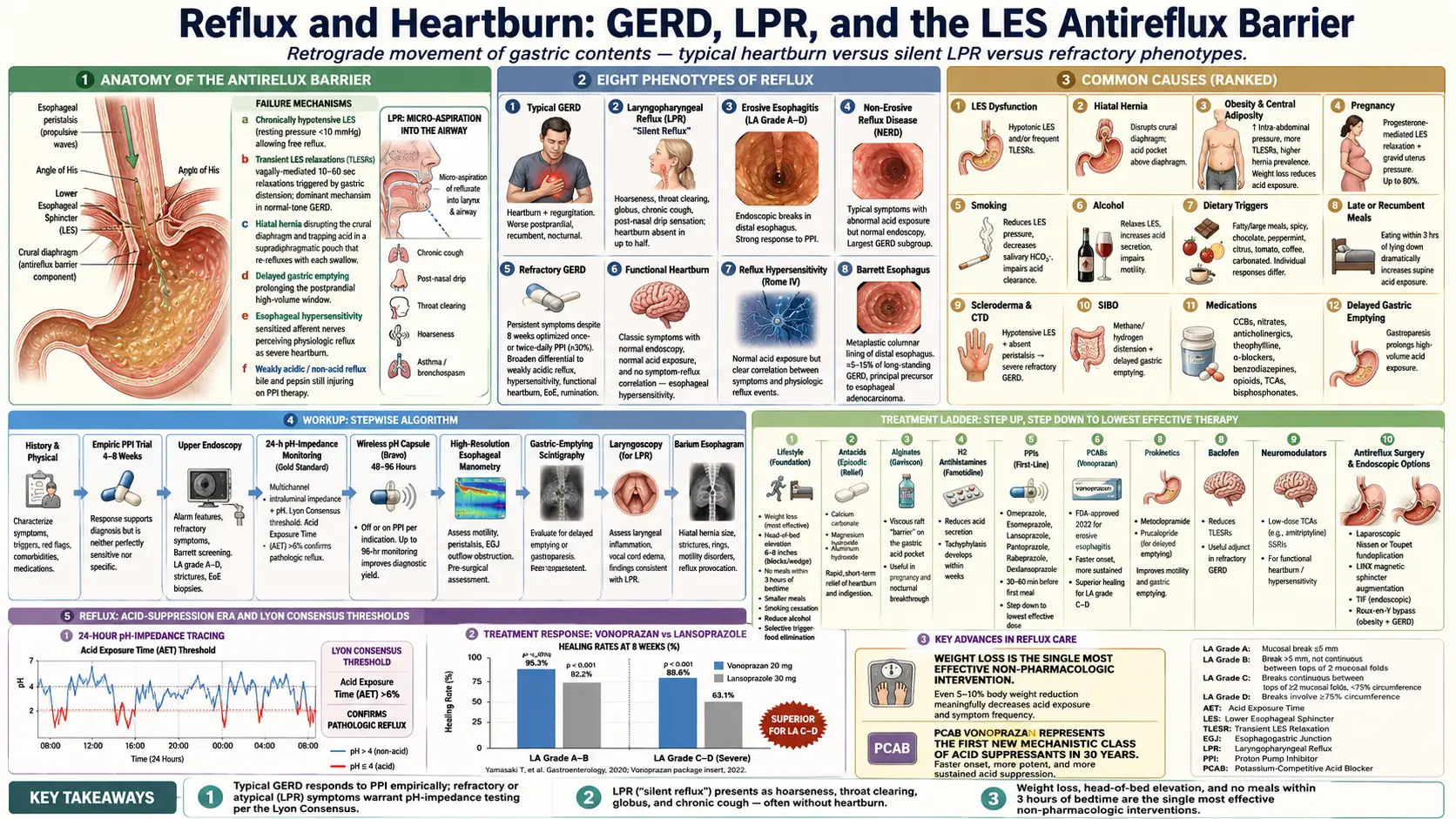 Reflux — scientific infographic poster