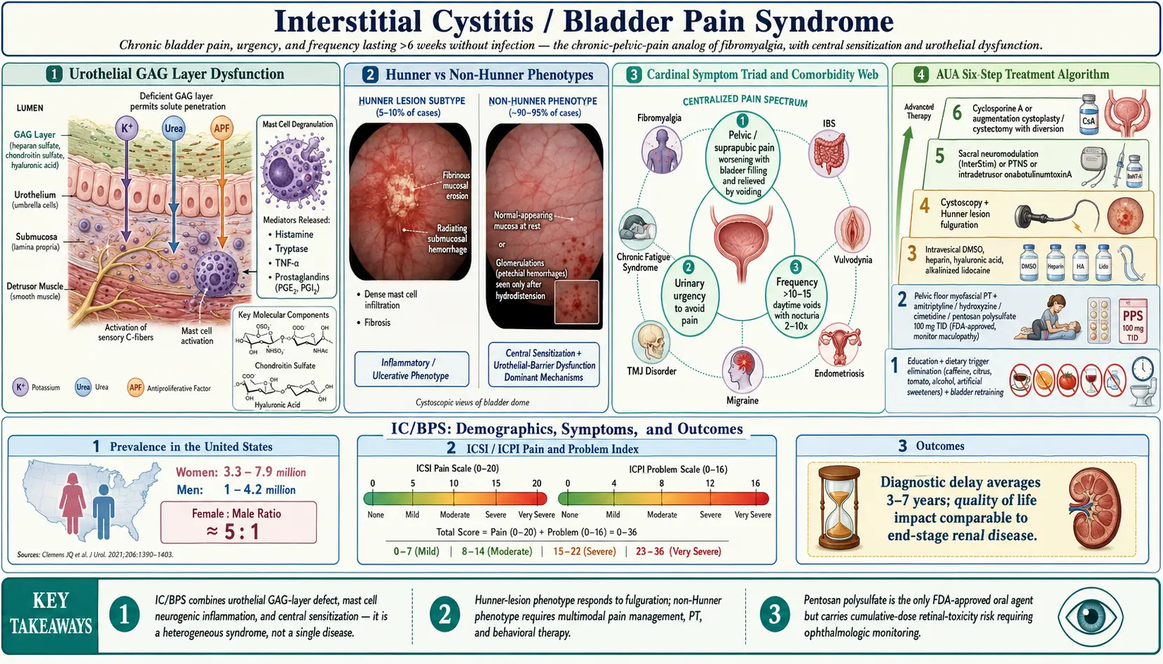 Interstitial Cystitis — scientific infographic poster