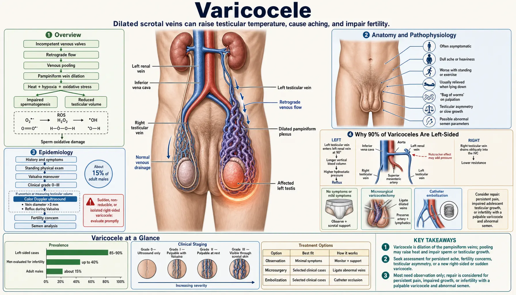 Varicocele — scientific infographic poster
