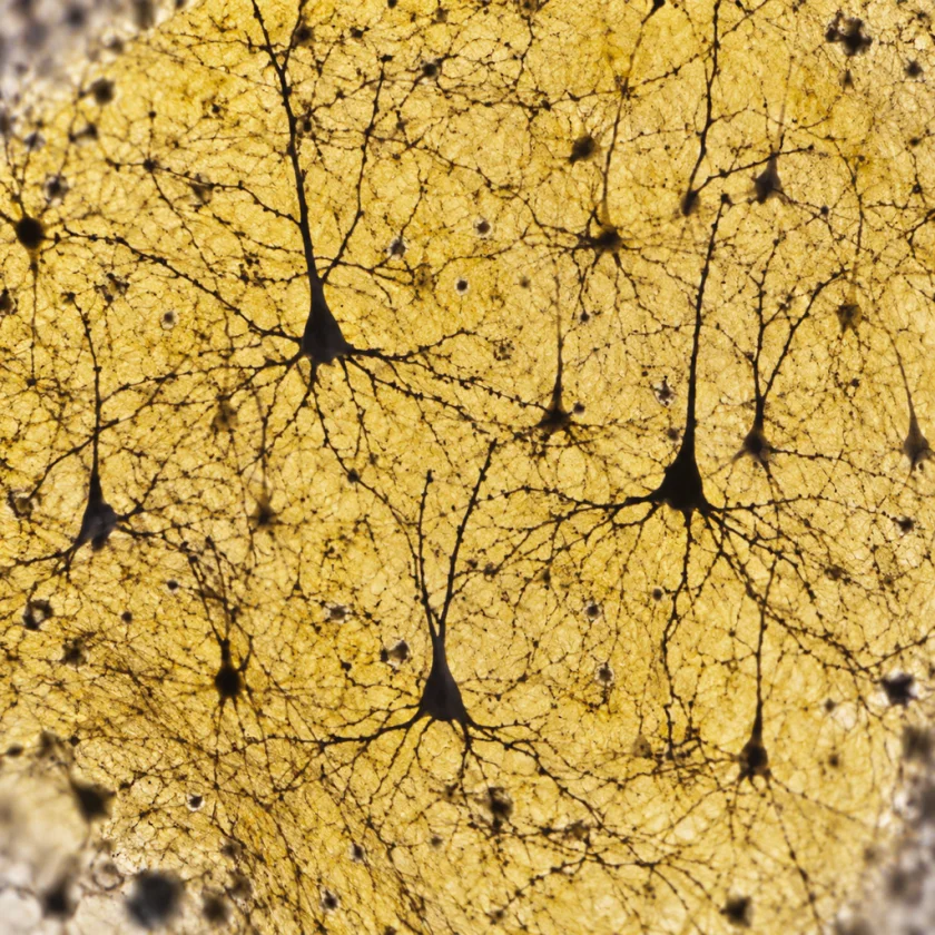 Nerve cells of the brain's frontal cortex