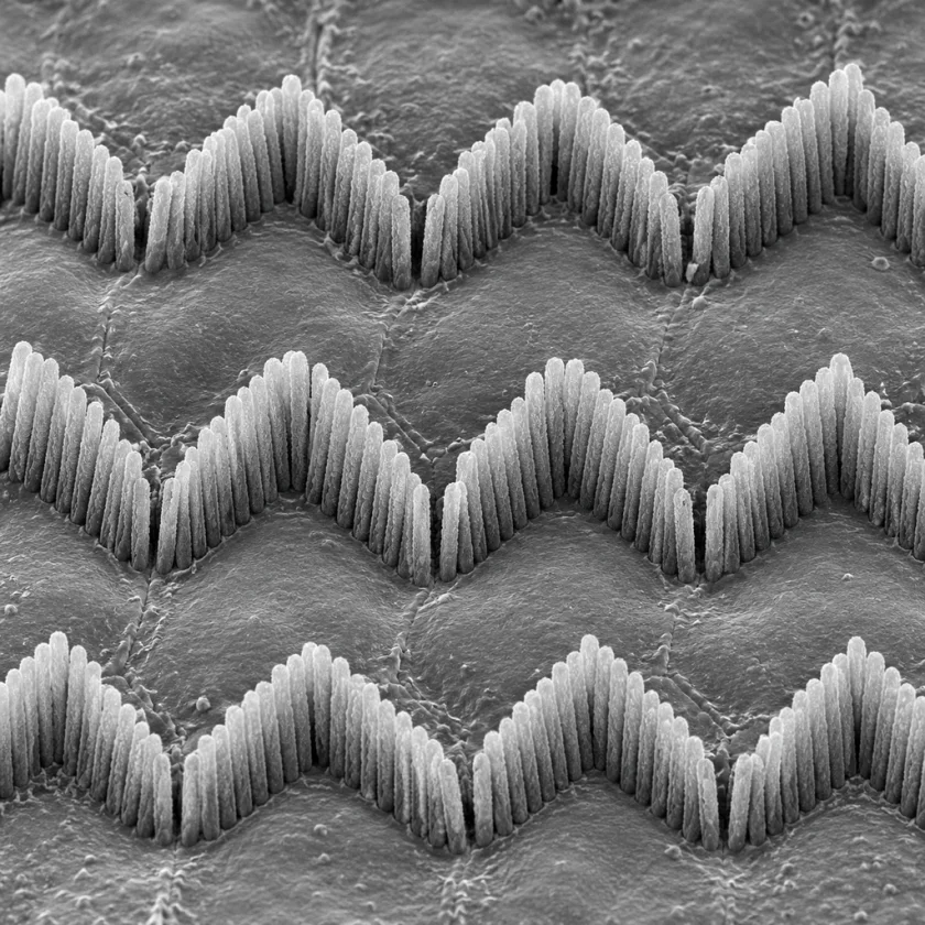 Sensory hair cells of the inner ear