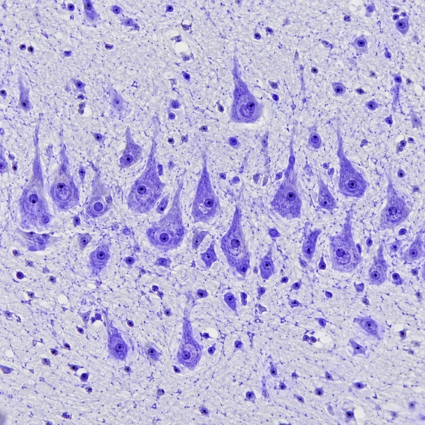 Nerve cells stained violet in brain tissue