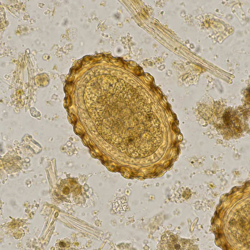 A roundworm egg, the kind identified in stool testing