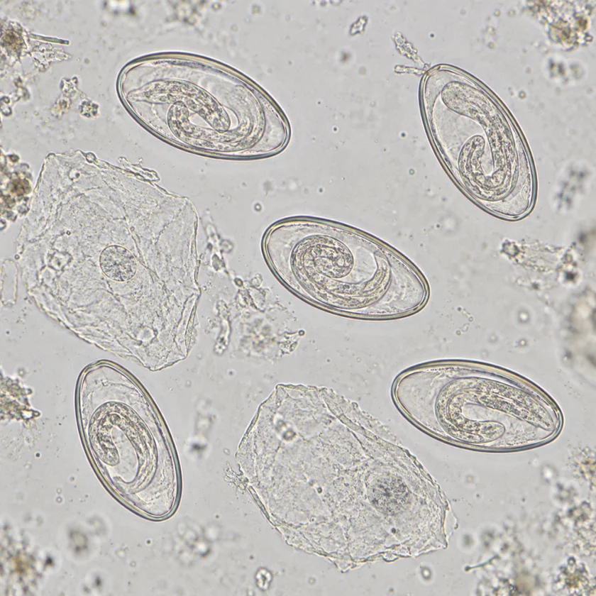 Pinworm eggs, from a common intestinal worm