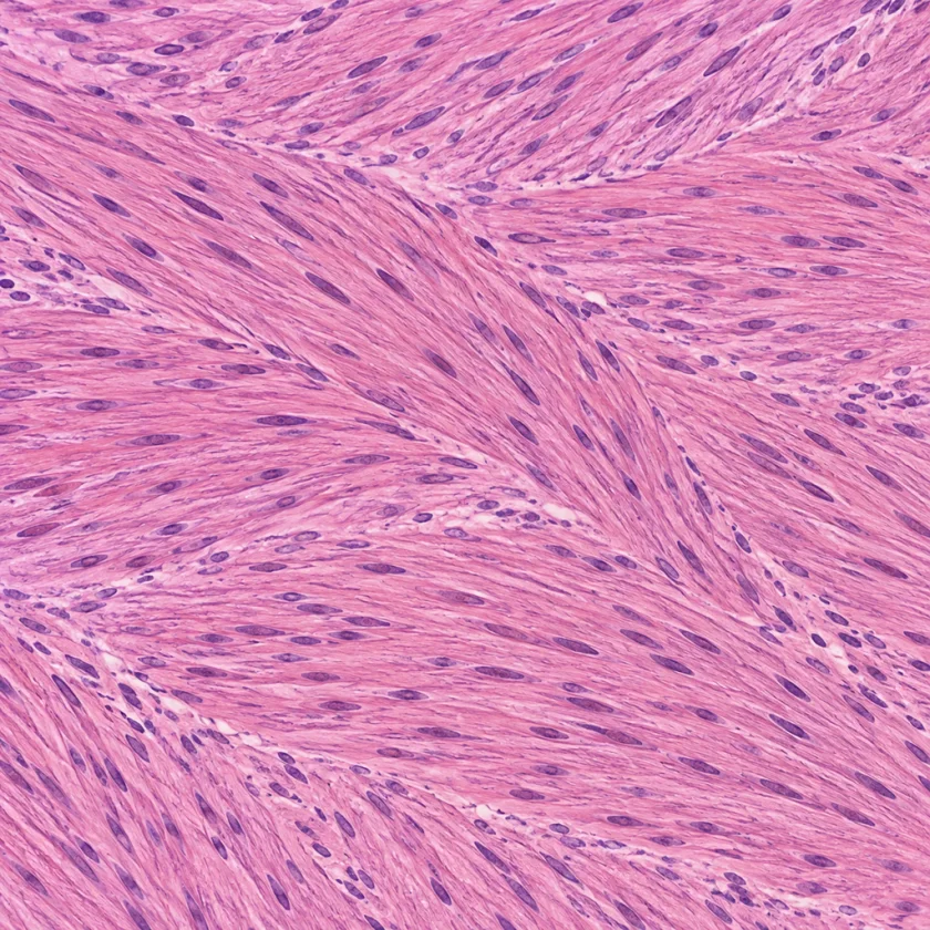 Uterine smooth muscle, the tissue at the centre of the question