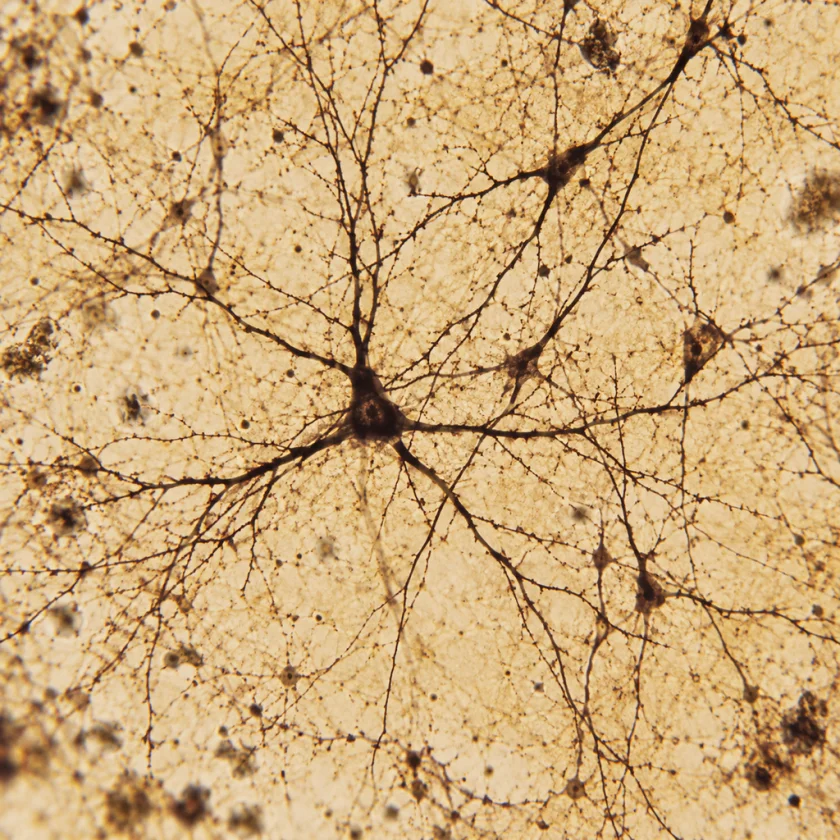 Nerve cells, where GABA signalling takes place