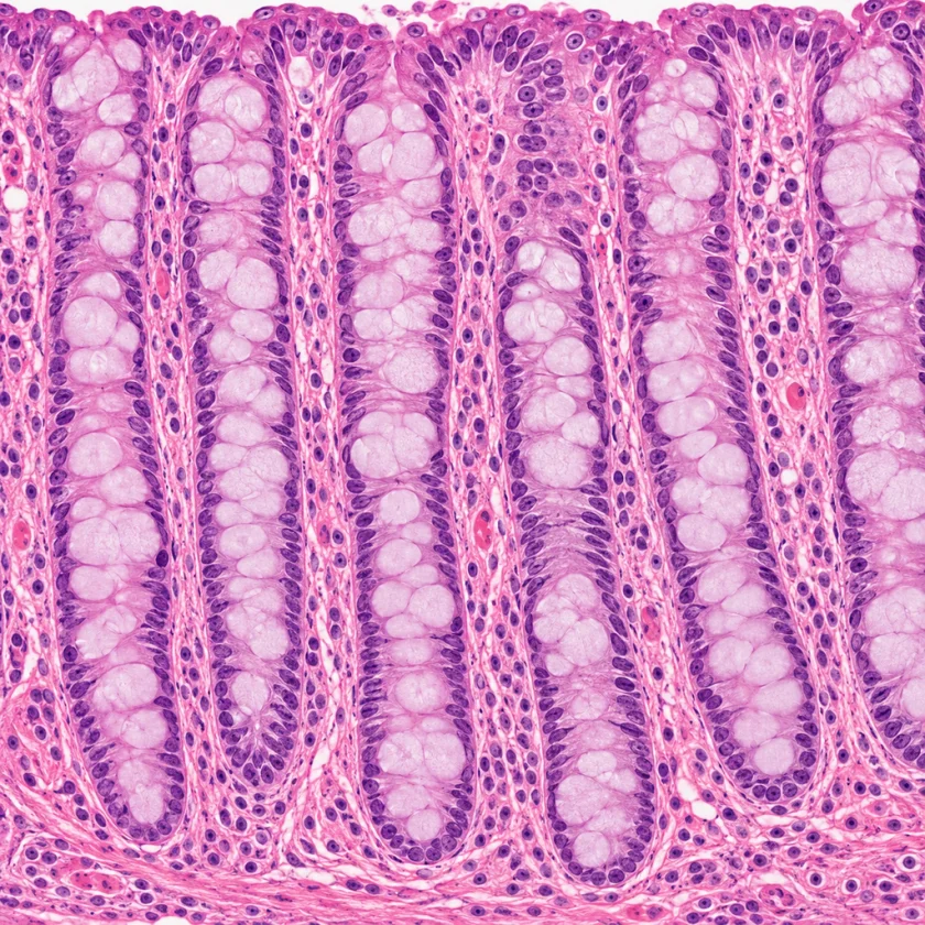 The large intestine lining, where fibre is fermented