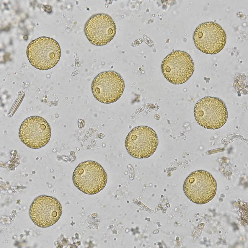 Grass pollen, a common hay-fever trigger
