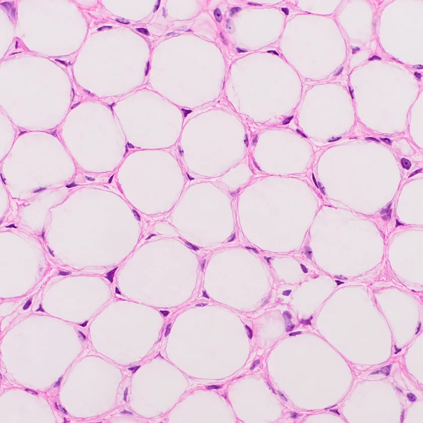 Fat tissue under the microscope