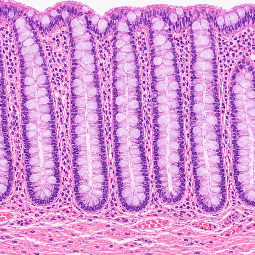 The lining of the large intestine