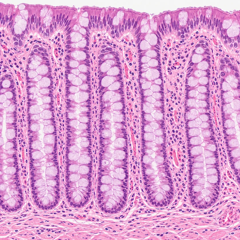 The colon lining, where haritaki acts