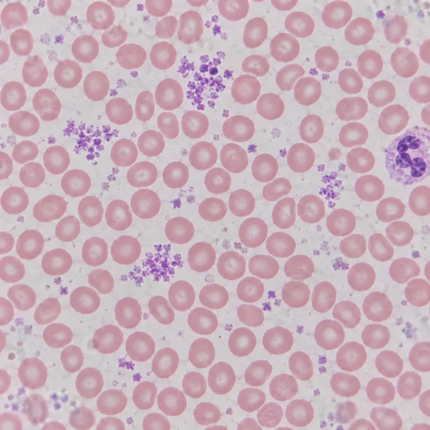 Platelets, the cells salicylates make less sticky