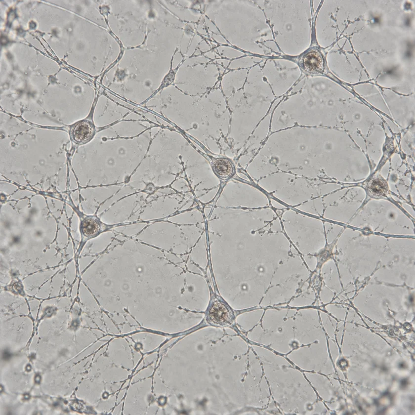 Nerve cells growing fibres, studied for nerve growth factor