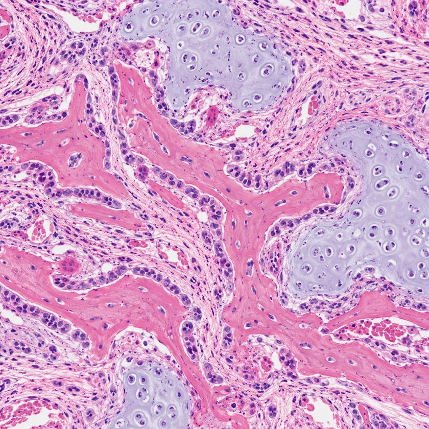 A healing bone fracture under the microscope