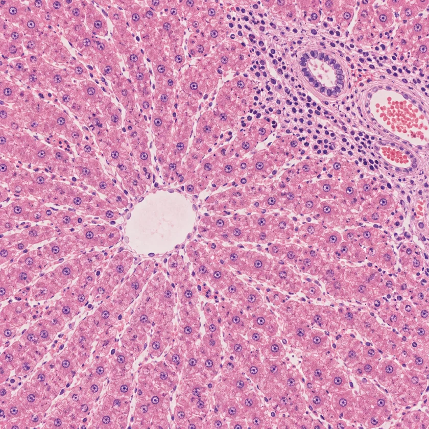 Microscope view of stained liver tissue showing pink hepatocytes, a central vein and scattered inflammatory cells