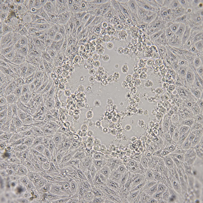 Cultured cells with a patch of virus damage