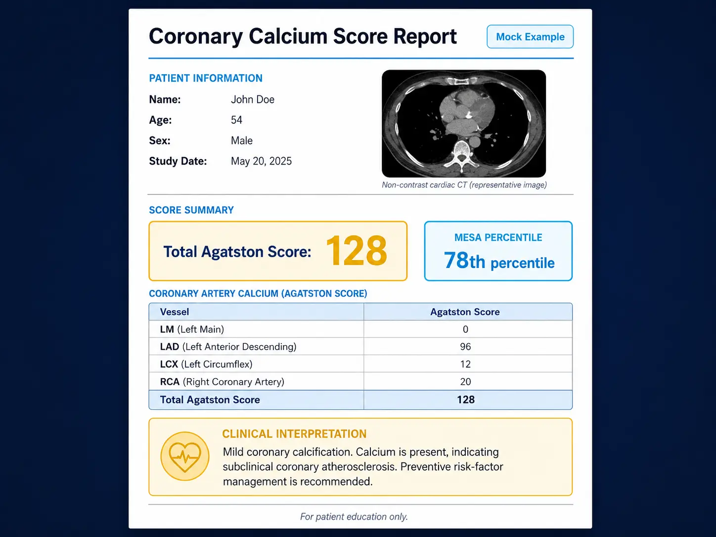 Sample CAC scan report layout with Agatston, MESA percentile, vessel breakdown