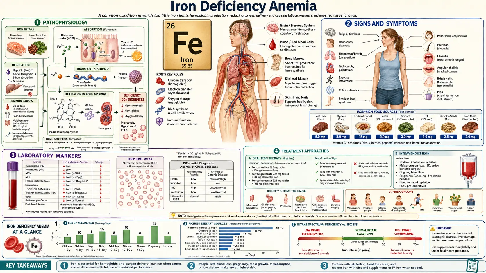 Iron Deficiency Anemia &mdash; scientific infographic poster