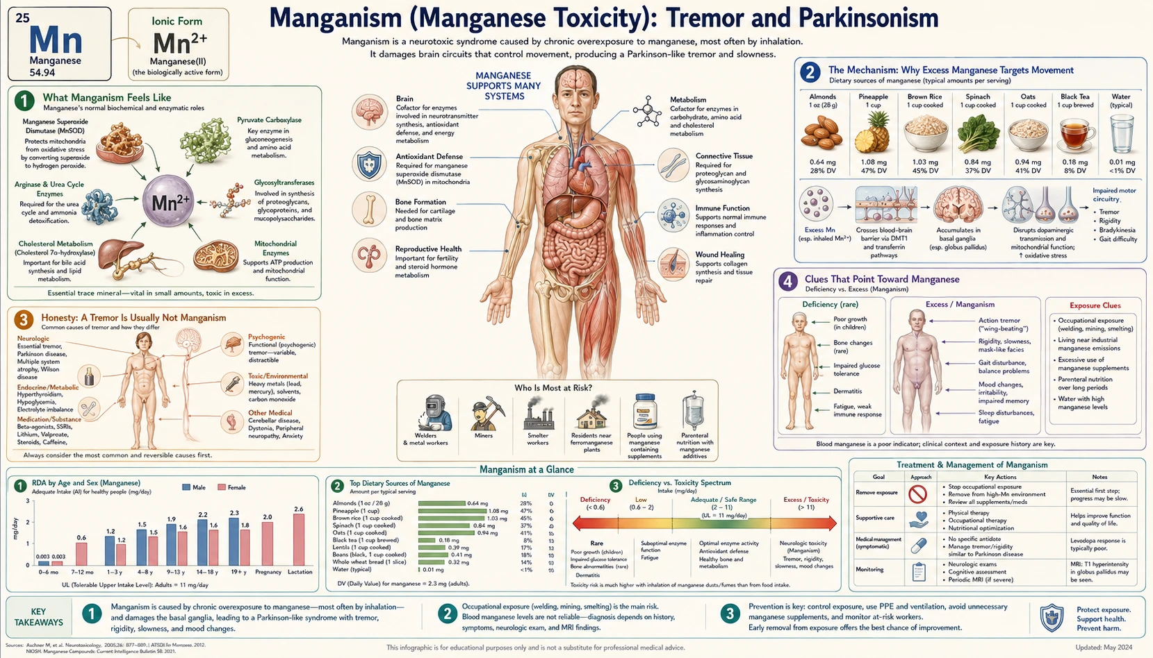 Tremor and Parkinsonism — scientific infographic poster