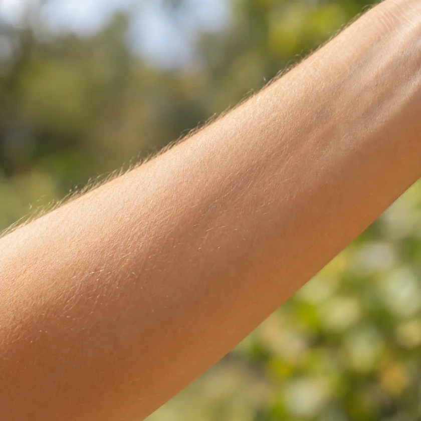 Close-up of healthy forearm skin in soft sunlight