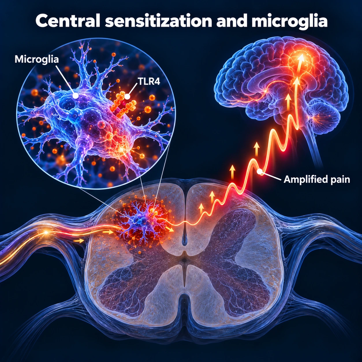 Infographic: microglia, TLR4 and amplified pain signals