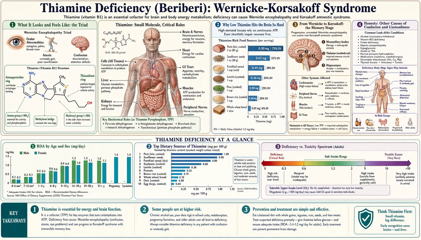 Wernicke Korsakoff Syndrome — scientific infographic poster