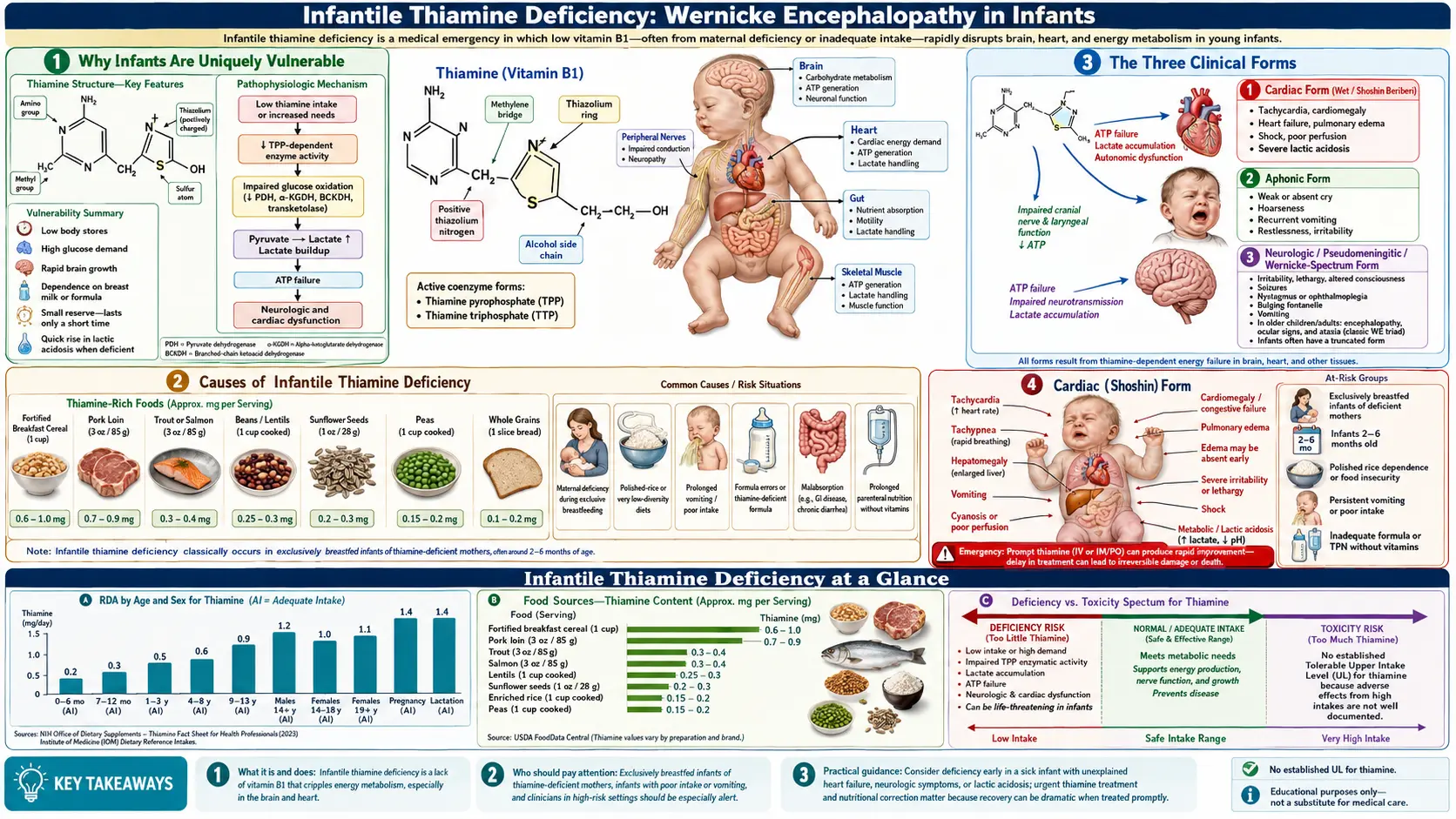 Infantile Thiamine Deficiency — scientific infographic poster